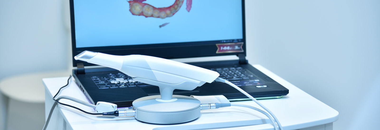 Dental intraoral 3d scanner