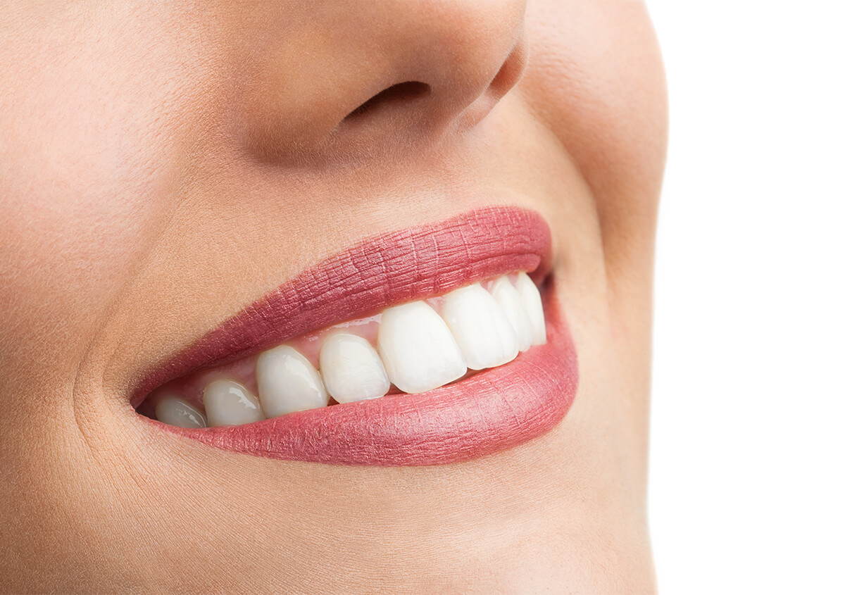 In Office Teeth Whitening Benefits in Willoughby Area