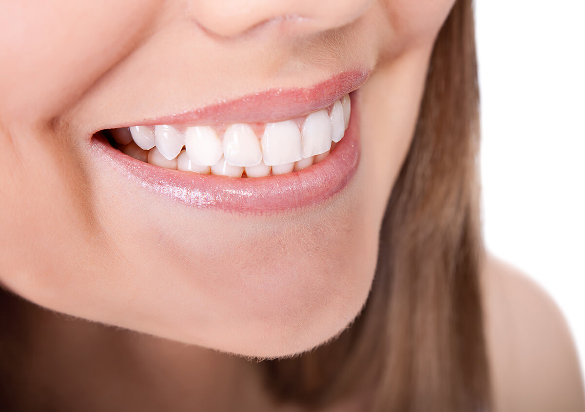 In-office Teeth Whitening Service Willoughby OH