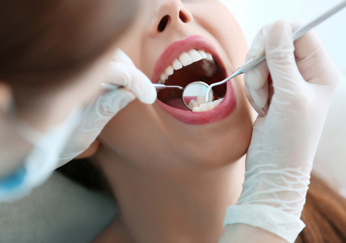 Remove Stains From Teeth in Willoughby OH area