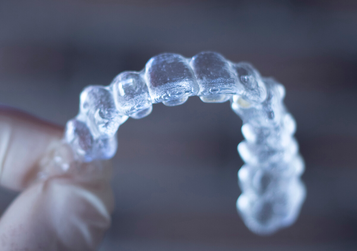 Invisalign Dentist in Willoughby OH Area